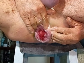 扩肛侠2025-14 dealings videos in asian china well-pleased