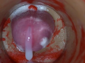 内射实录——体内镜头捕捉男性深喉射精 gay asian porn blog